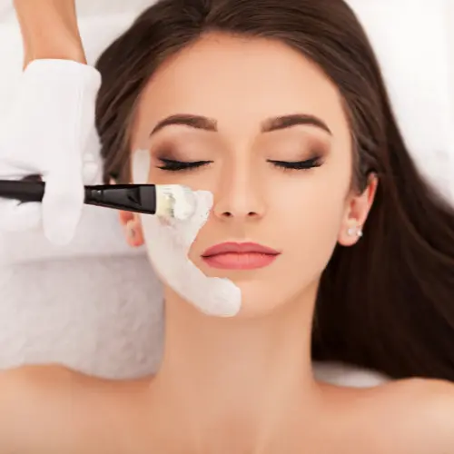 chemical-peel-for-pigmentation