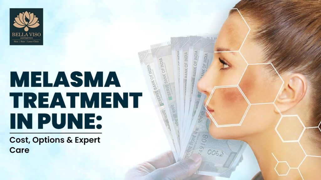 Melasma Treatment in Pune